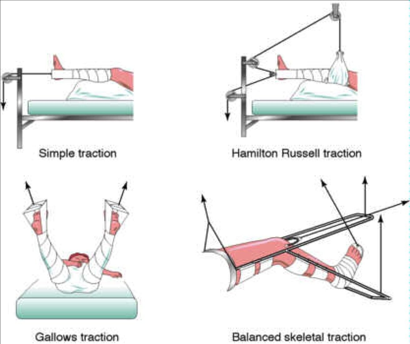 Traction Worksheets